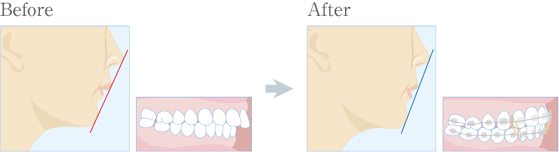 矯正歯科 Ayaデンタルオフィス